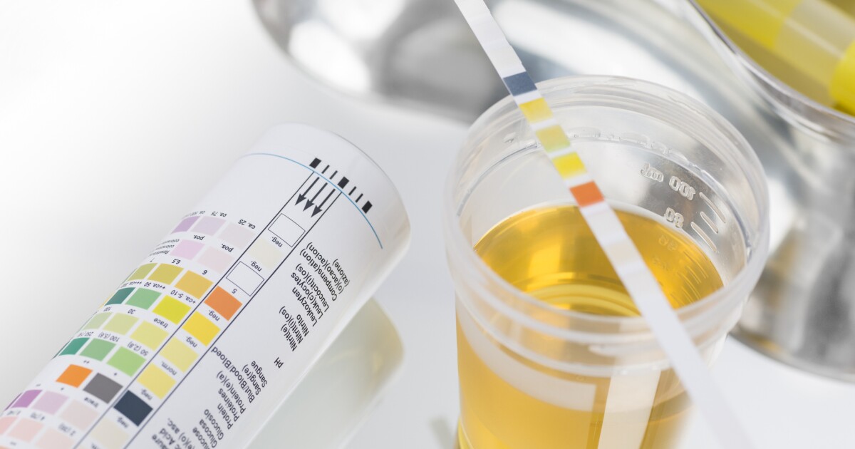 Preventing UTIs: Uncovering Hidden Causes.