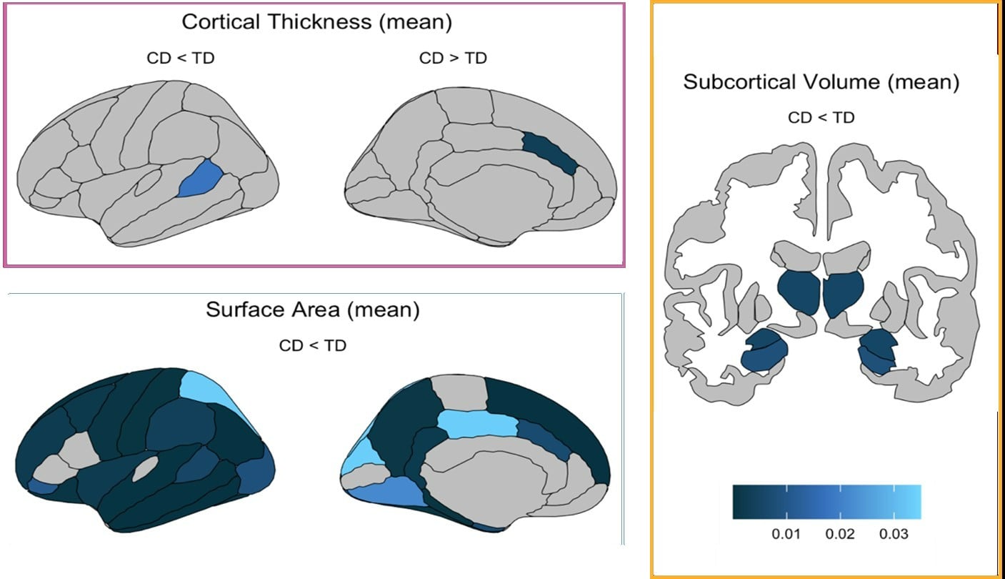 Featured image for Conduct Disorder in Youth Tied to Significant Brain Structure Changes