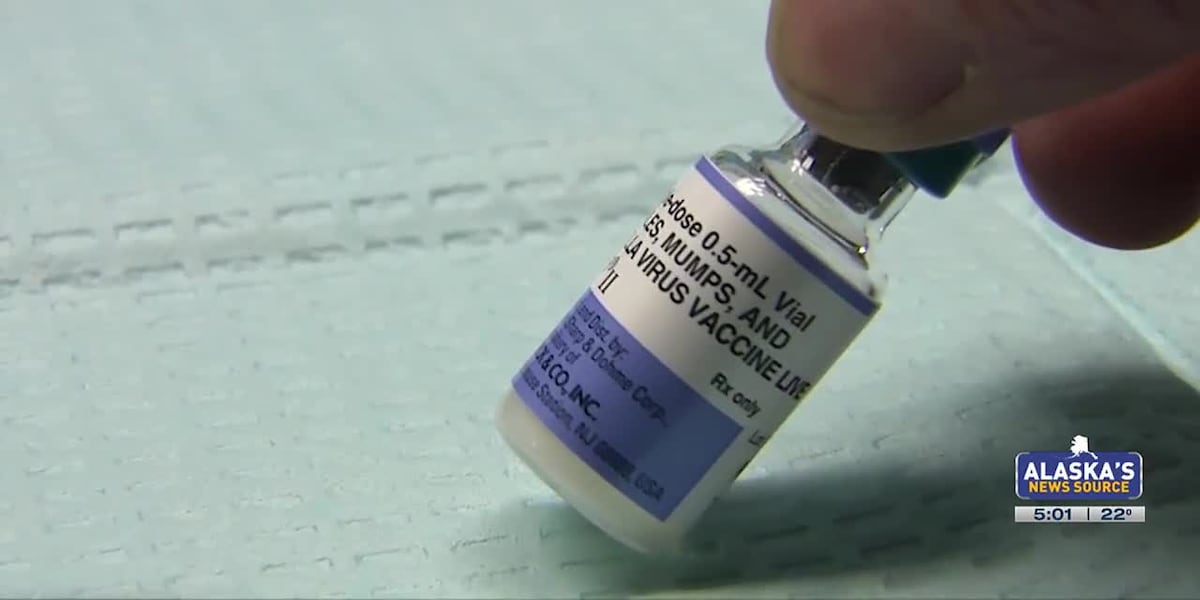 Featured image for Suspected Mumps Case at Anchorage Middle School Prompts Activity Cancellations