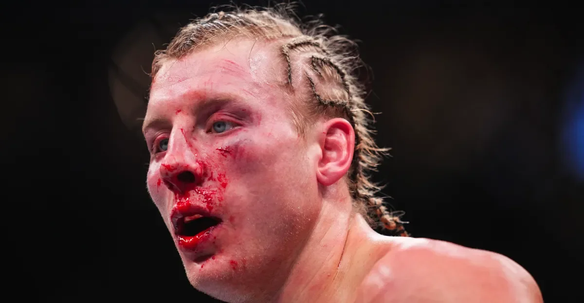 Pimblett’s grit tested in UFC 324 battle as Gaethje edges him, with White sharing battered-face photo