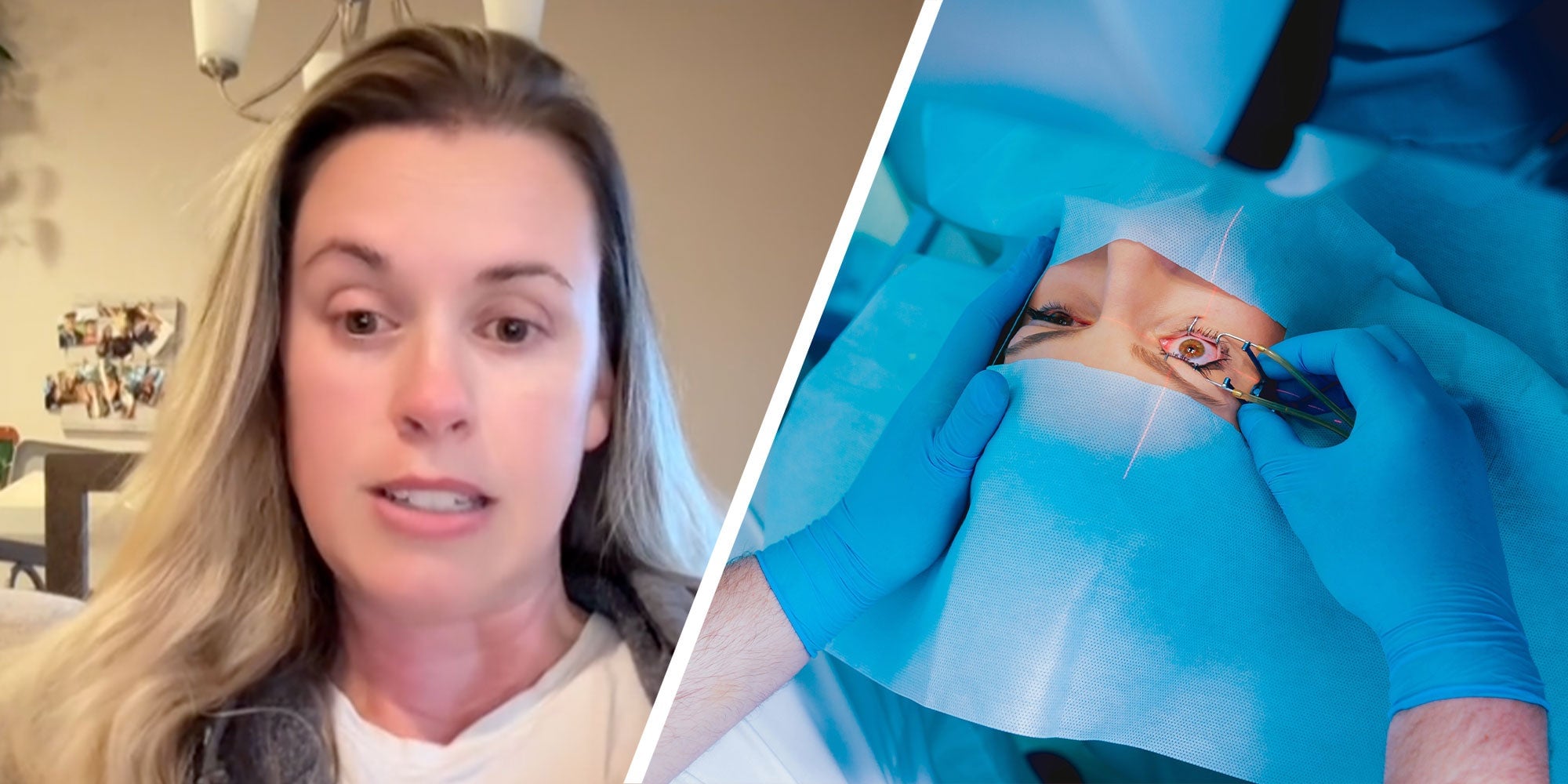 Featured image for Woman's Cautionary Tale: LASIK Surgery Regret