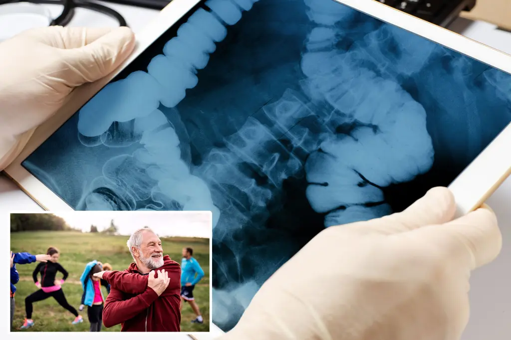 Featured image for Optimal Exercise Times Identified to Lower Bowel Cancer Risk