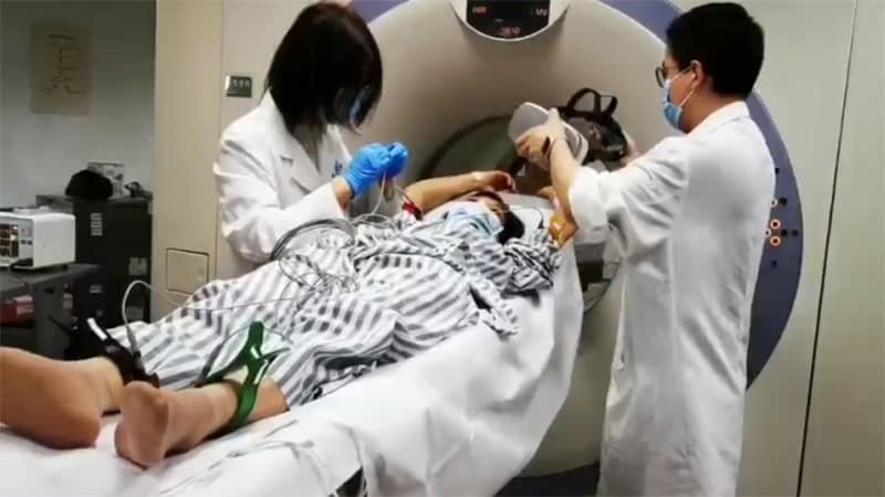 "Assessing the Need for Mental Stress Testing in ANOCA"