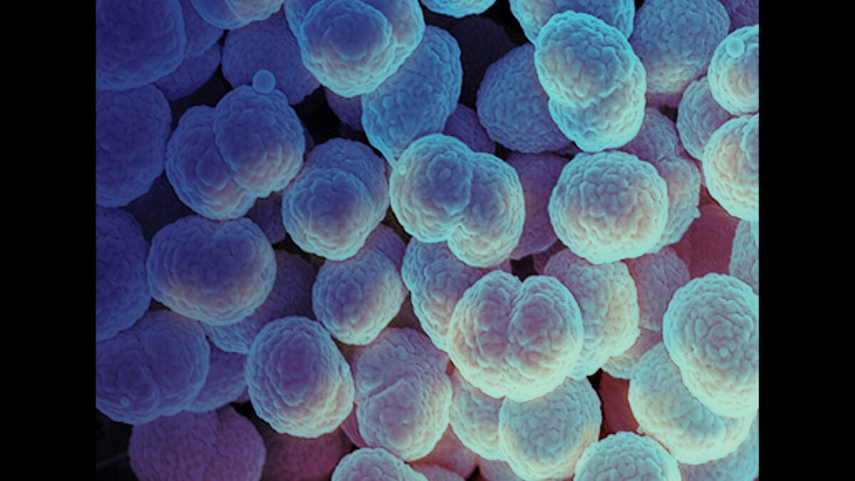 Featured image for Alaska Reports First Gonorrhea-Related Death Amid Rising Infections