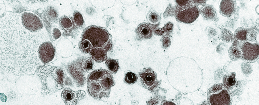 Featured image for The Significance of a Little-Known Virus We All Carry.