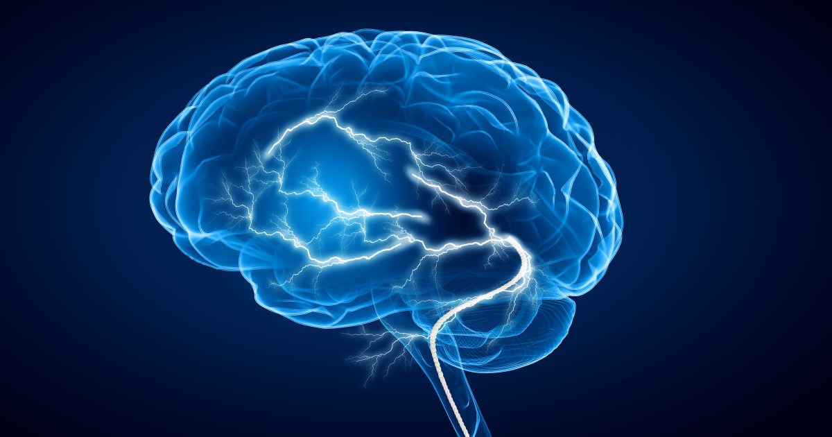 Featured image for The Age-Related Decline of Brain Function: What You Need to Know.