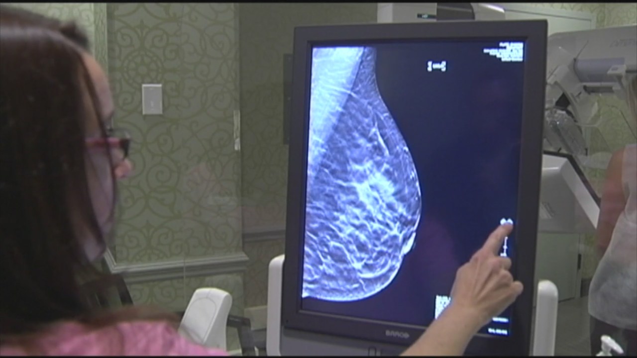 Featured image for Controversy over mammogram recommendations for women under 50.