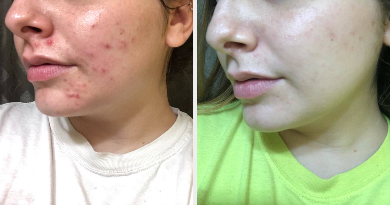 "Transform Your Skin with These 24 Effective Skincare Products"