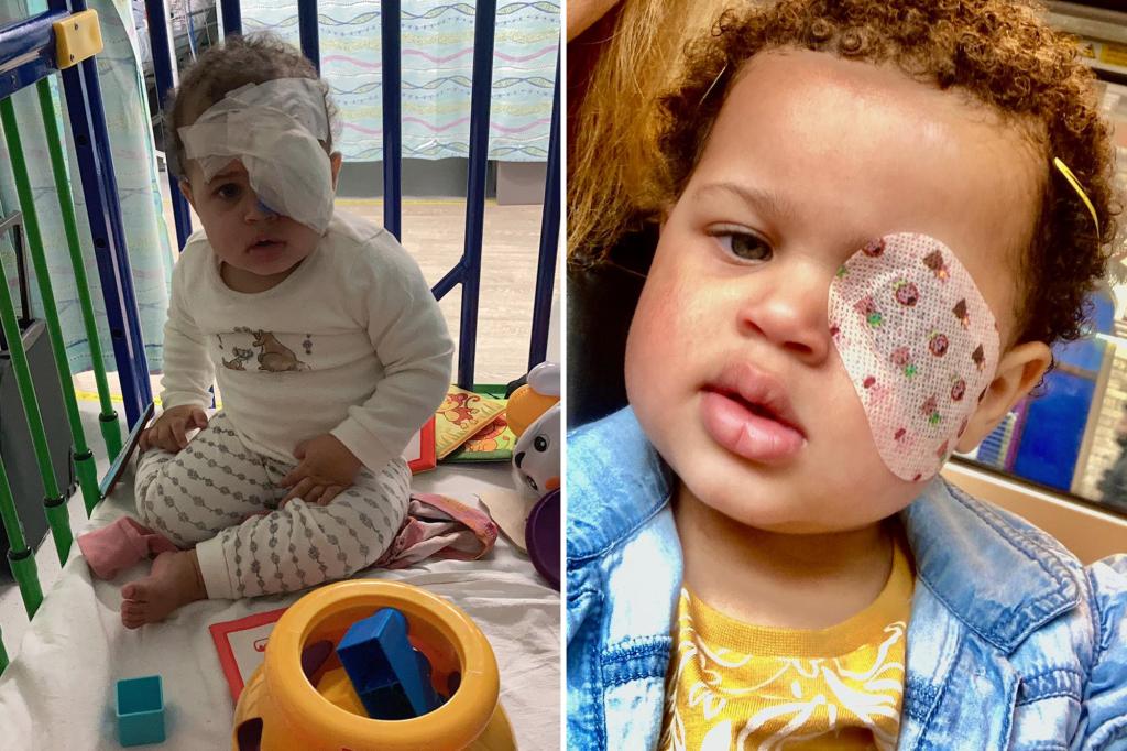 Misdiagnosed Eczema Leads to Baby's Tragic Eye Loss