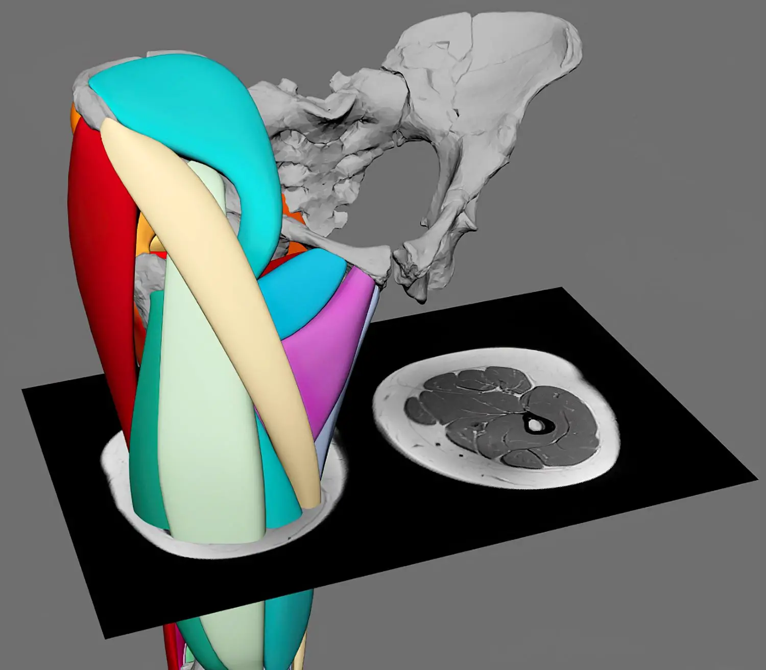 Featured image for "3D Muscle Reconstruction Confirms 3.2 Million-Year-Old Lucy Walked Upright"