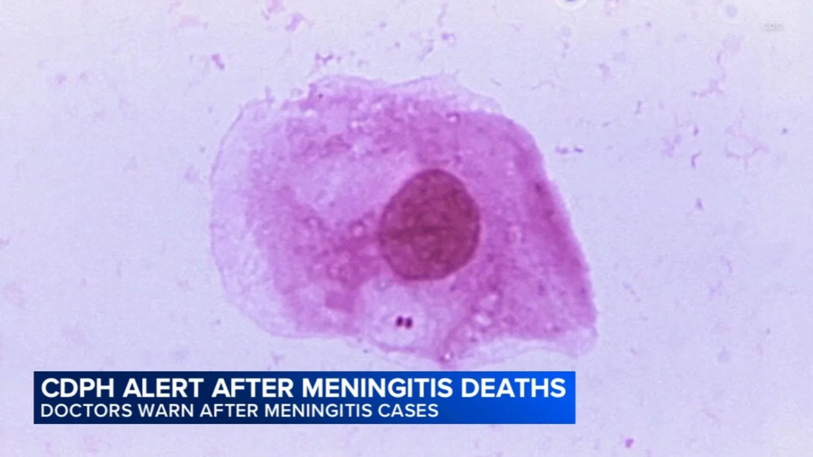 Chicago faces meningococcal outbreak as two die and cases rise