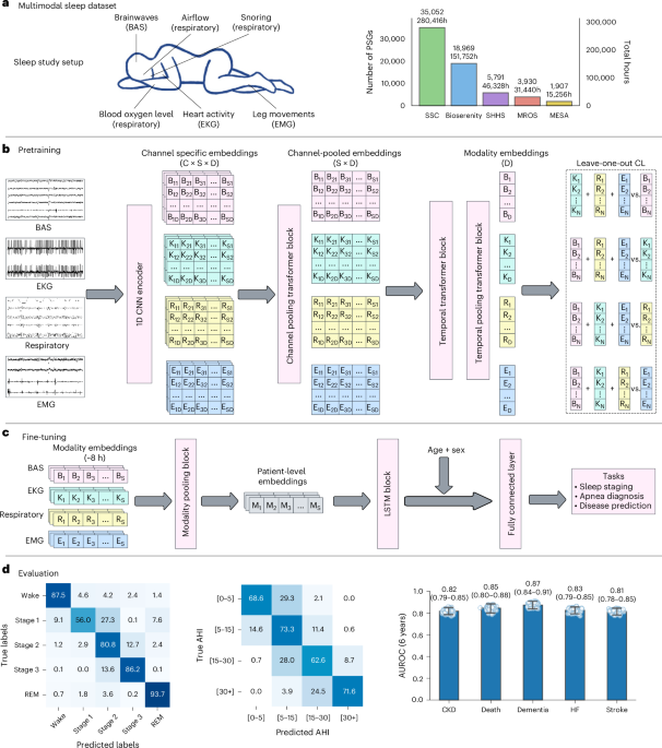 AI Model Uses Sleep Data to Predict Long-Term Disease Risks
