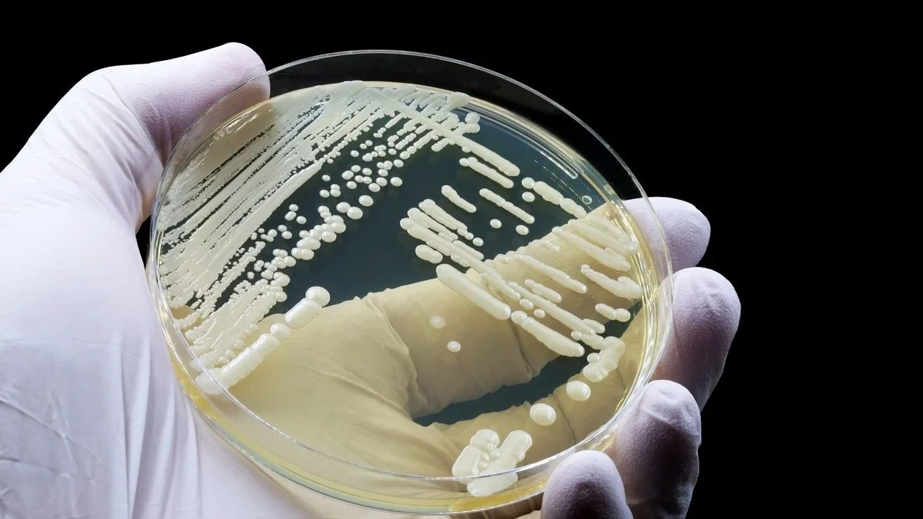 Tennessee grapples with surge of drug-resistant Candida auris tied to hospital care