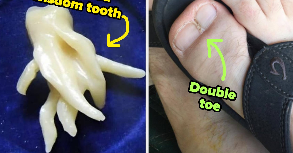 Featured image for "Chilling and Unseen: 30 Super Freaky Photos of the Human Body"