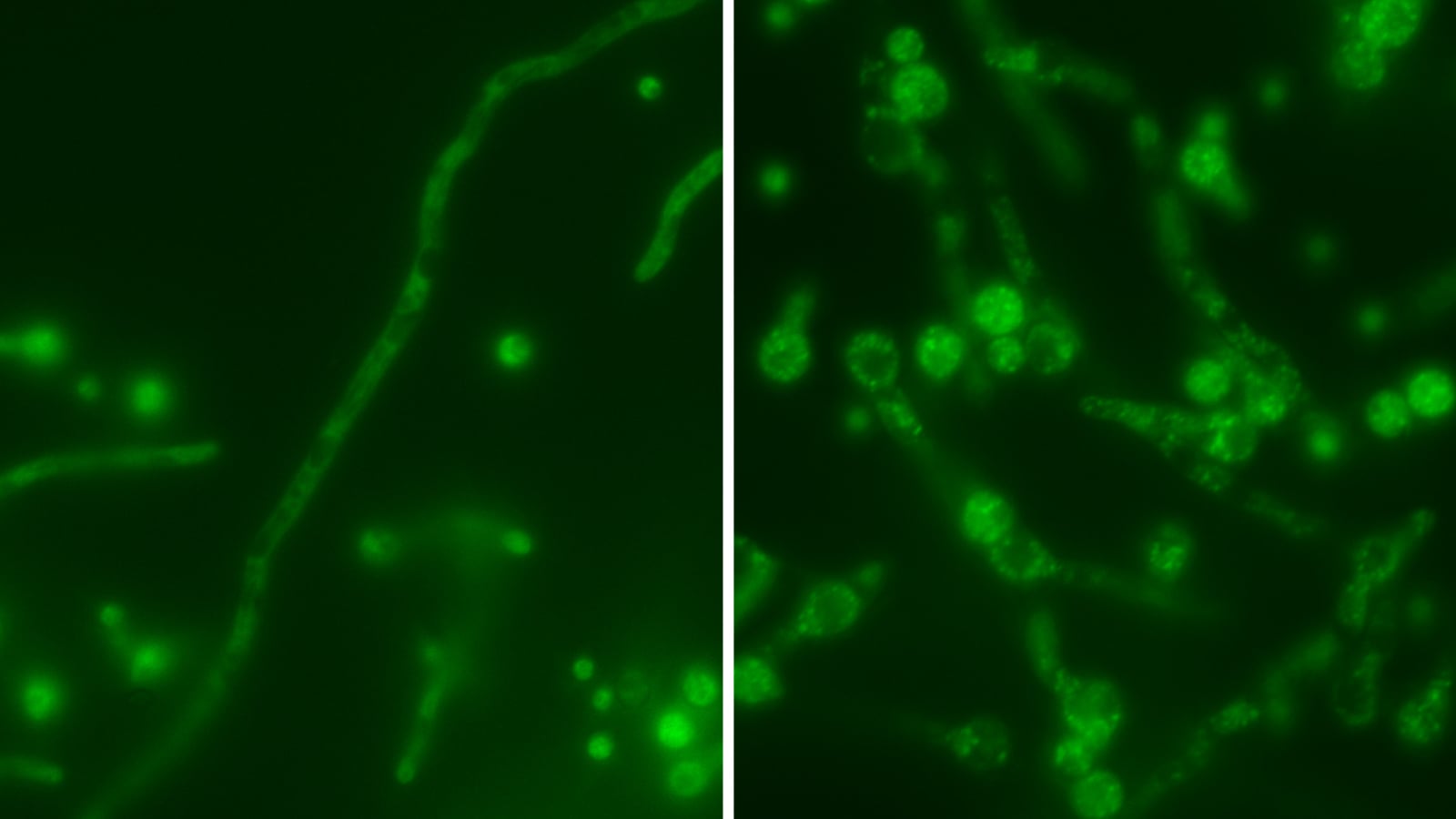 Featured image for 'Russian nesting doll' virus amplifies threat by hiding in deadly fungus