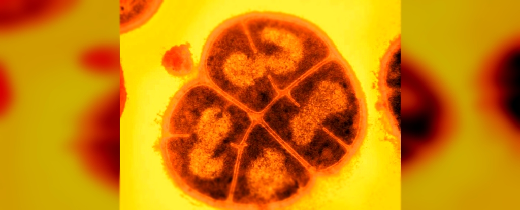 Featured image for Scientists Uncover How a Microbe Thrives on Radiation, Offering Hope for Space Travel