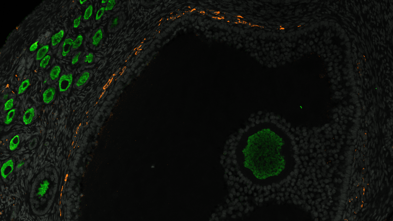 Featured image for New Primate Ovarian Map Advances Understanding of Female Infertility