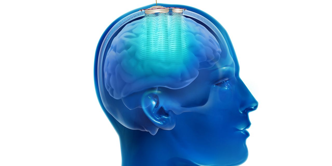 Revolutionary Ultrasound Therapy Shows Promise in Treating Alzheimer's and Cancer