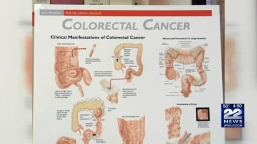 Featured image for "Rising Colon Cancer Cases in Young Men: Lifestyle and Prevention Guidelines"