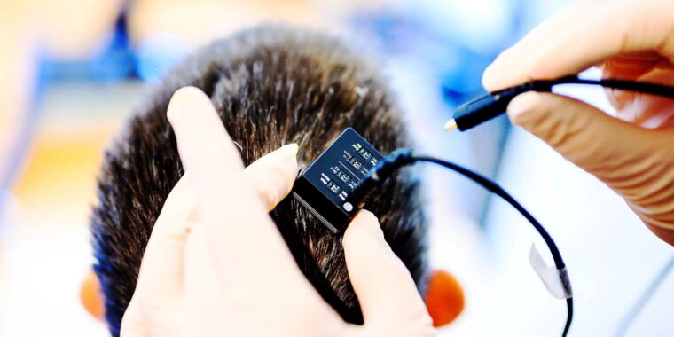 Featured image for Revolutionary AI Brain Implants Enable Unprecedented Communication for Paralyzed Patients