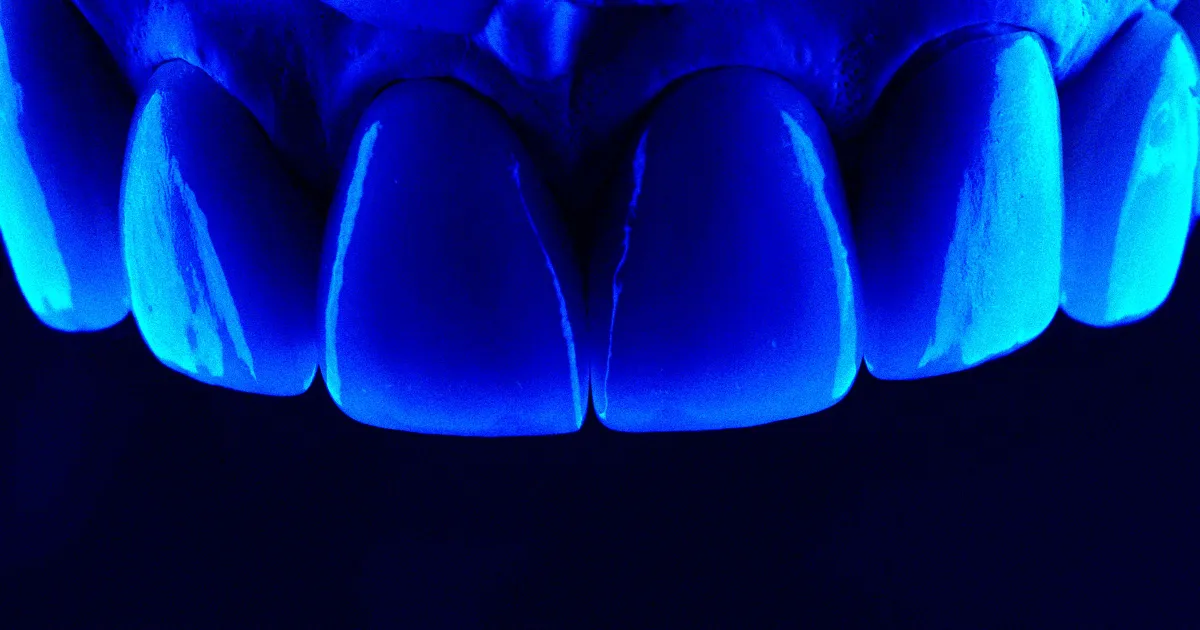 Featured image for Scientists Develop Breakthrough Gel to Regrow Tooth Enamel and Prevent Cavities