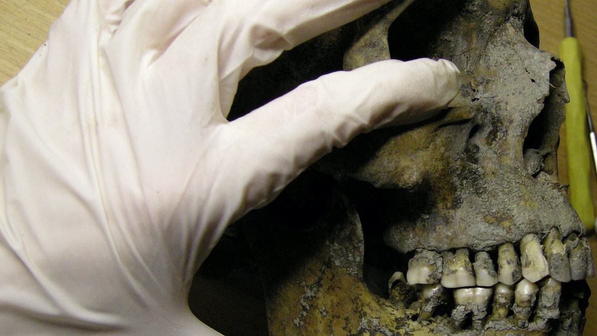 Featured image for Vikings' Dental Dilemma: Coping with Toothache and Decay