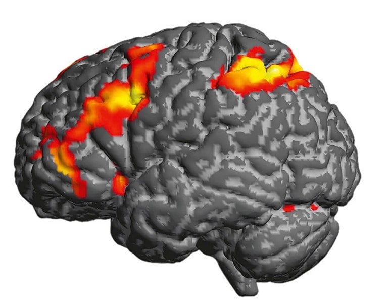 Featured image for Uncovering Concealed Brain States Through Math Models.