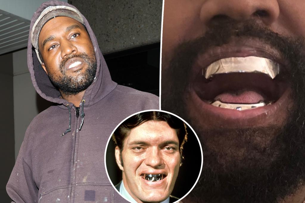 Featured image for Kanye West Unveils $850K Titanium Dentures Modeled After James Bond Character Jaws