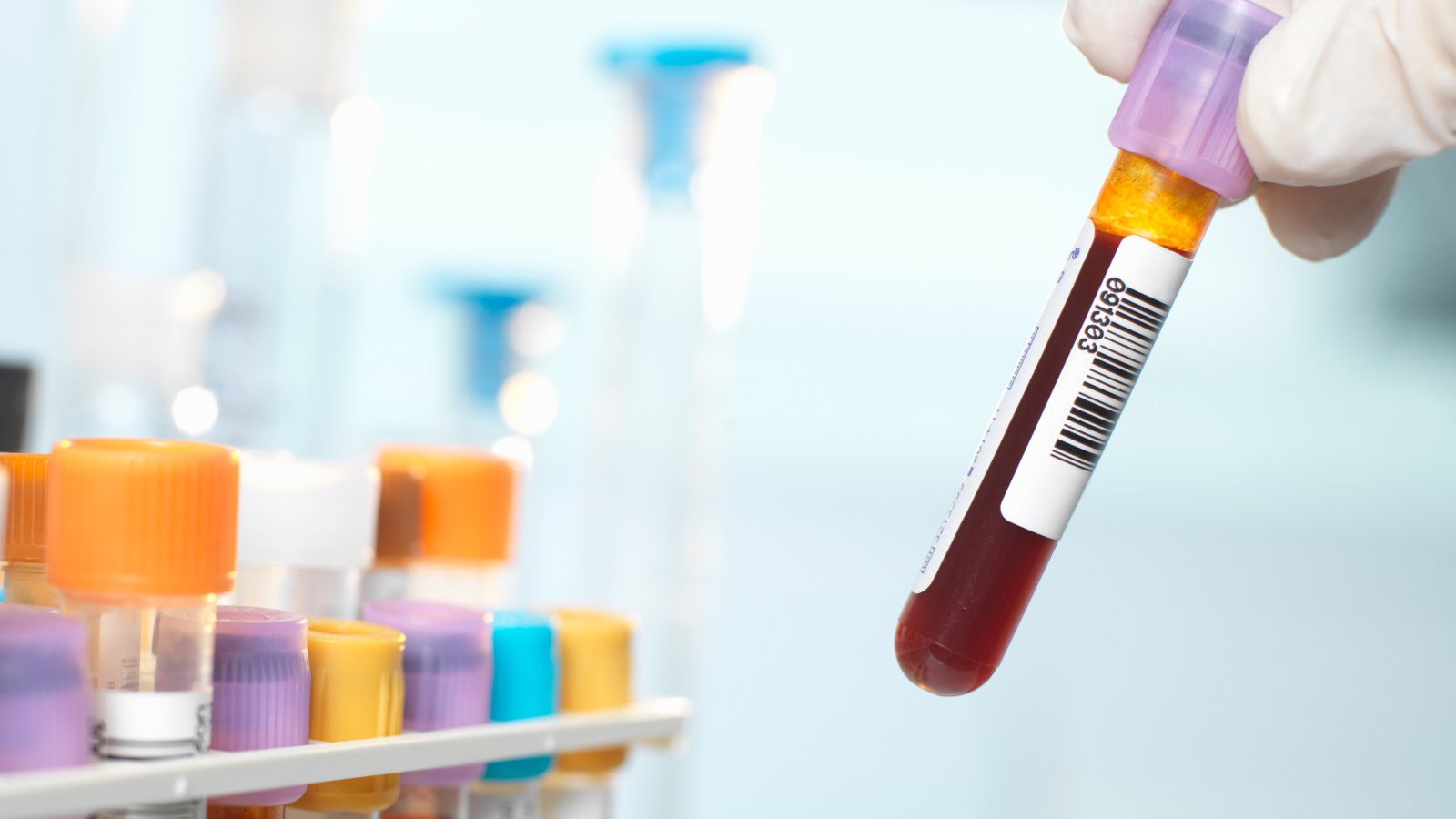 Featured image for Unique Blood Type Discovered in Guadeloupe Woman, the Rarest on Earth