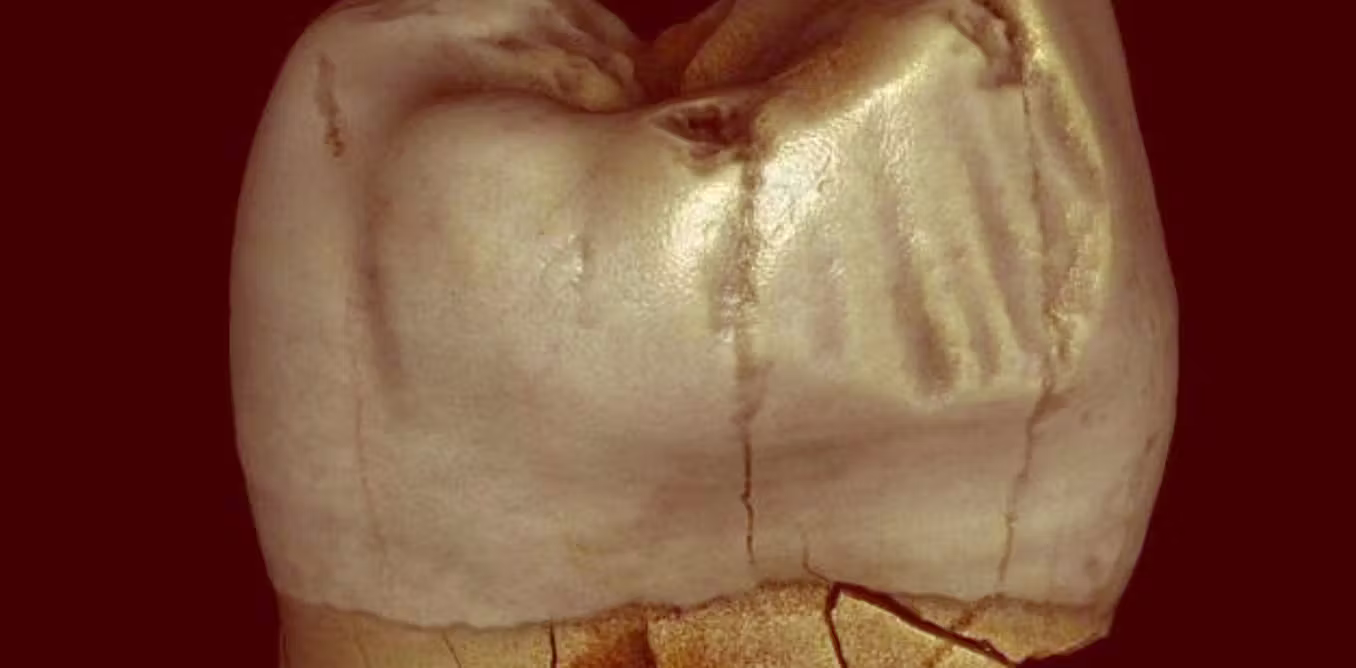 Featured image for Ancient Toothpick Grooves May Not Be Man-Made