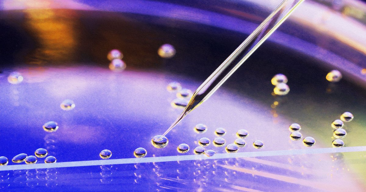 Featured image for Advancements in Stem Cell Therapy Offer Hope for Multiple Sclerosis Treatment