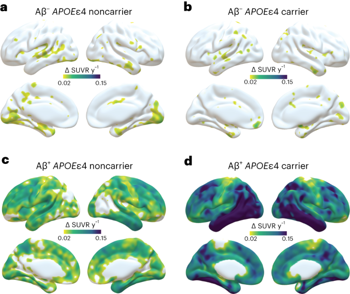 The Impact of APOEε4 on Longitudinal Tau Pathology Amplified by Amyloid β