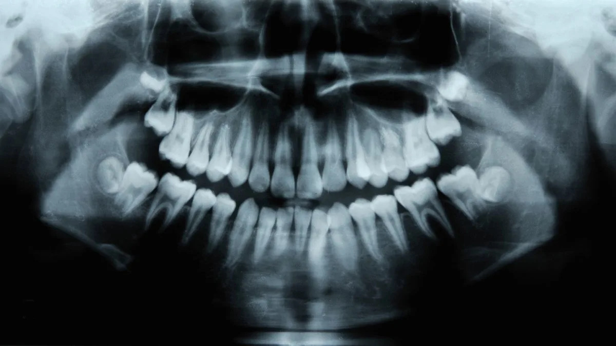 "Revolutionary Medicine Unlocks Humans' Hidden Third Set of Teeth"