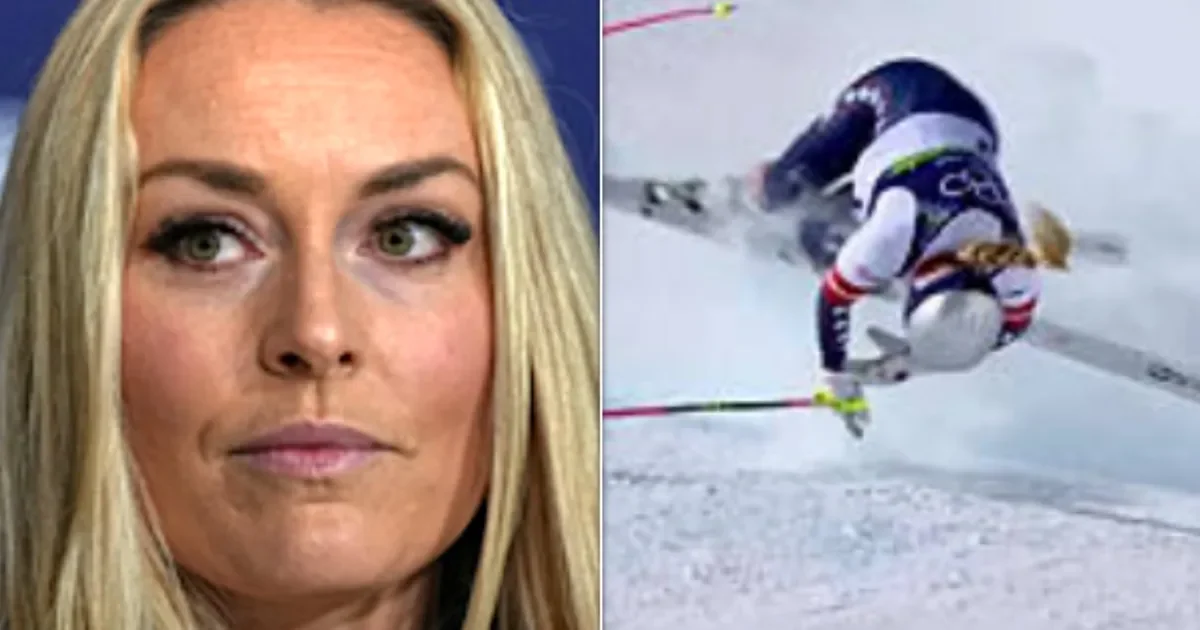 Lindsey Vonn Shows Off X‑Ray After Major Tibia Injury
