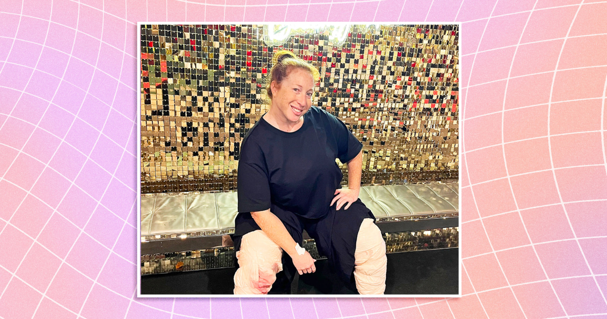 Featured image for "Dancer's Journey: Living with Lipedema and Undergoing Treatment"