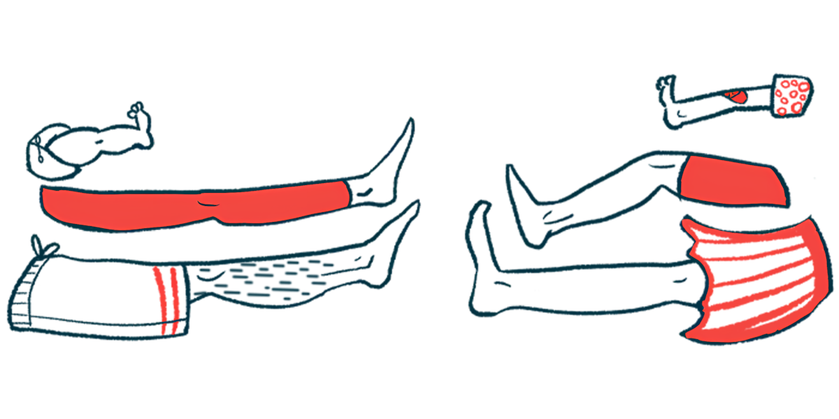 Featured image for Study Confirms Cannabinoids Relieve MS Spasticity