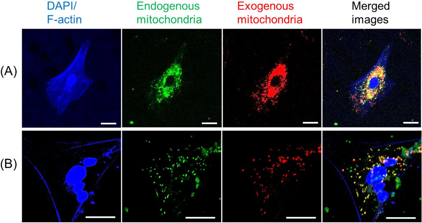 Mitochondrial Transplantation Boosts Cardiac Arrest Recovery in Rats