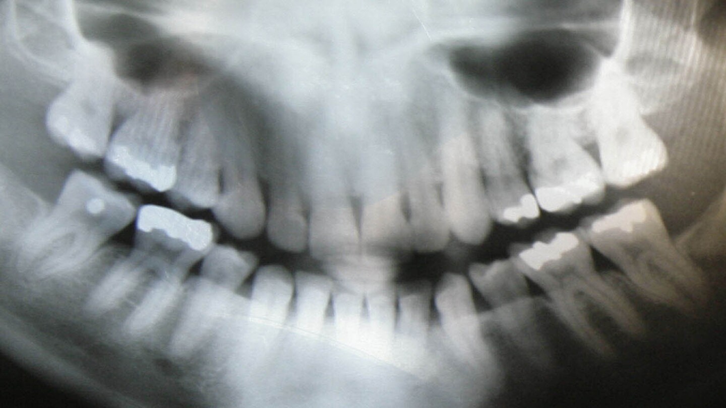 Featured image for "Ditch the Lead Apron: New Recommendation for Dental X-rays"