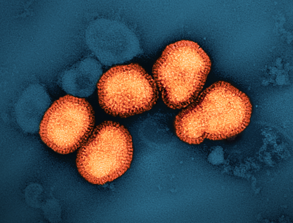 "NIH Launches Human Trials for Promising Universal Flu Vaccine"