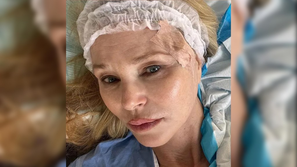 Featured image for "Christie Brinkley's Skin Cancer Journey: Diagnosis, Treatment, and Recovery"