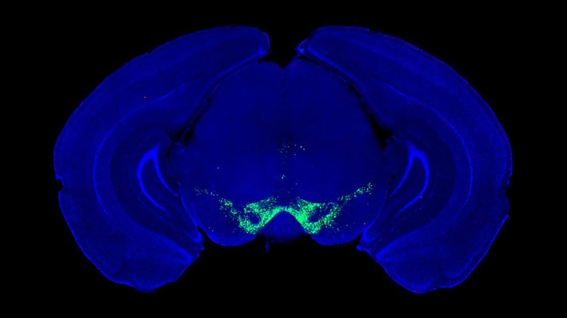 Featured image for Reevaluating Dopamine's Role in Parkinson’s Movement