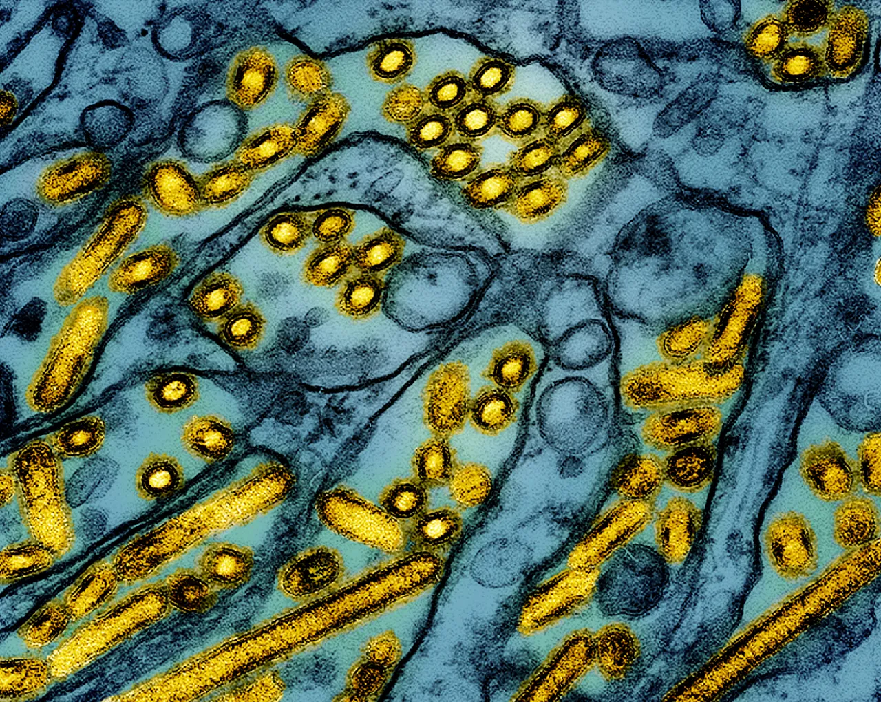 Hawaii's First Avian Flu Detection Sparks Widespread Concerns