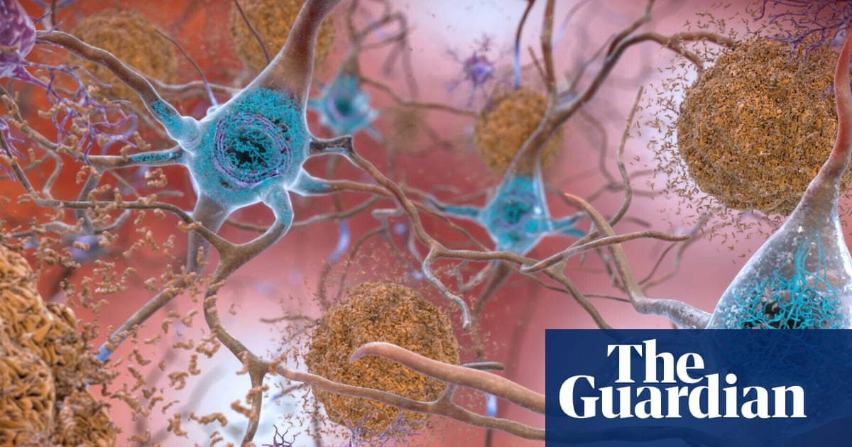 FDA advisers recommend approval of Alzheimer's drug lecanemab.