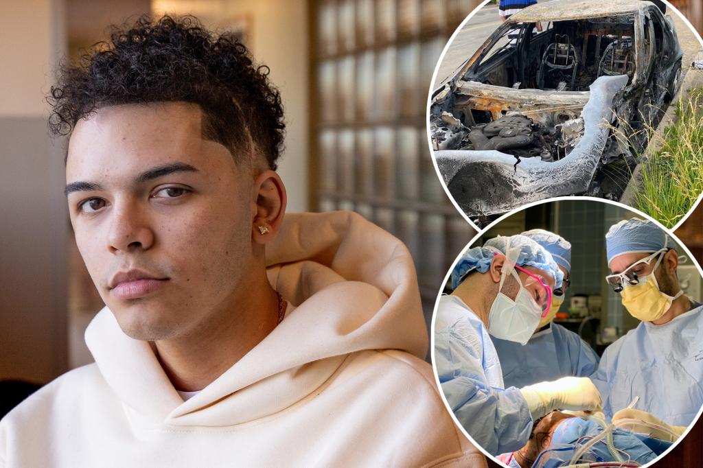 "NYC Teen Defies Odds, Walks Again After Fiery Car Crash"
