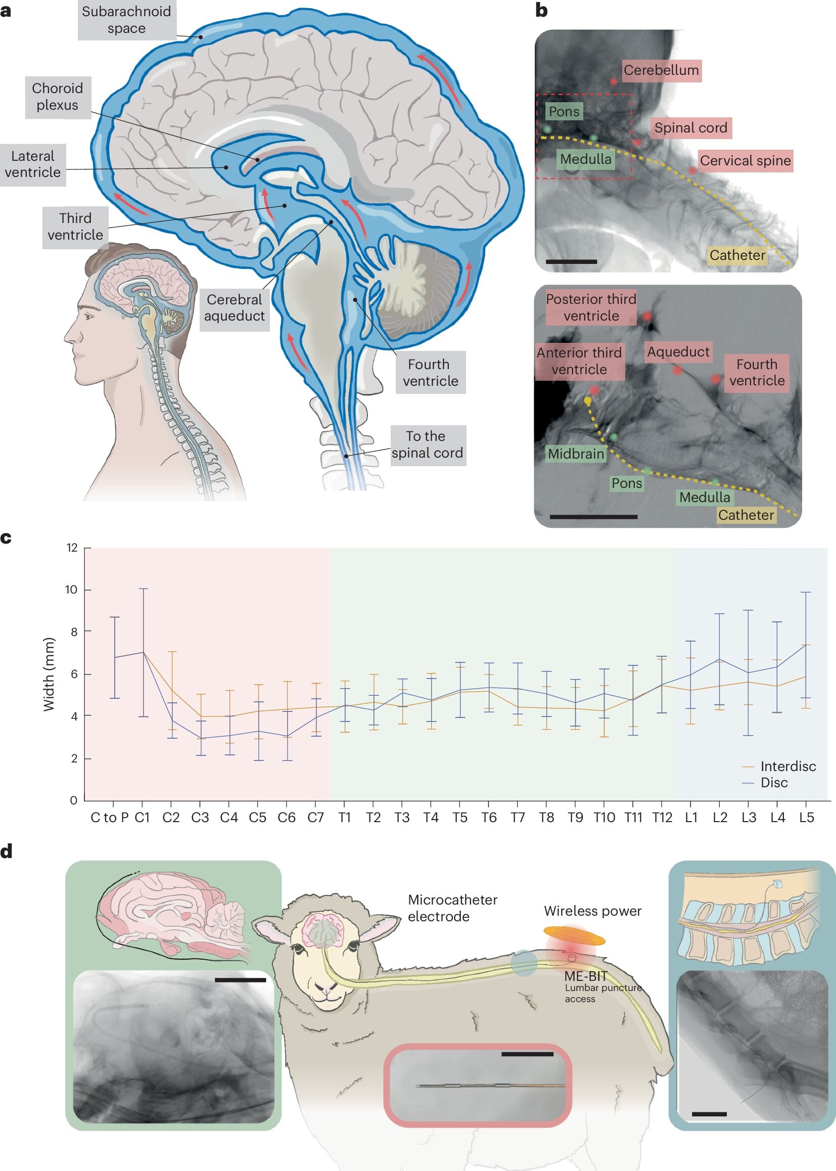 Featured image for Revolutionary Neural Interface Enables Brain Access Without Surgery