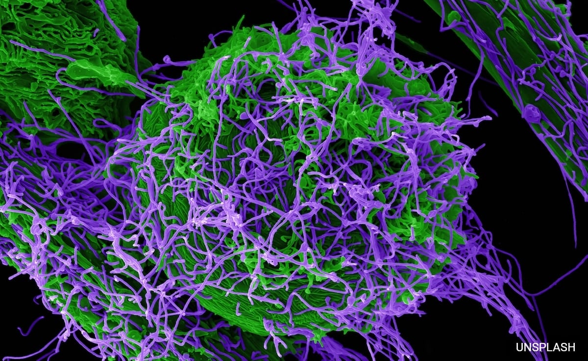 "Chinese Lab Engineers Mutant Ebola with Severe Symptoms"