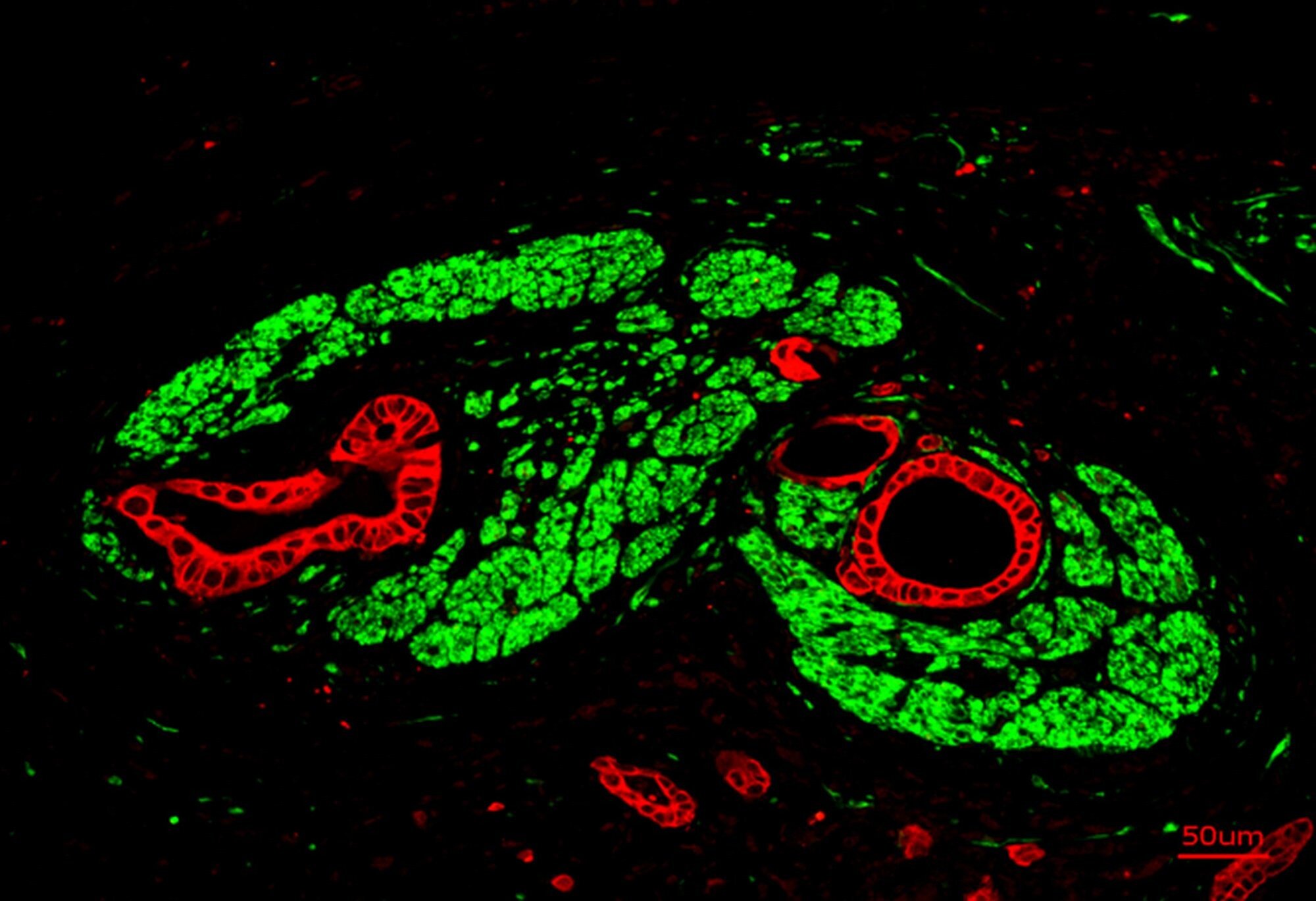 Featured image for Scientists Discover Synapse Formation in Pancreatic Cancer