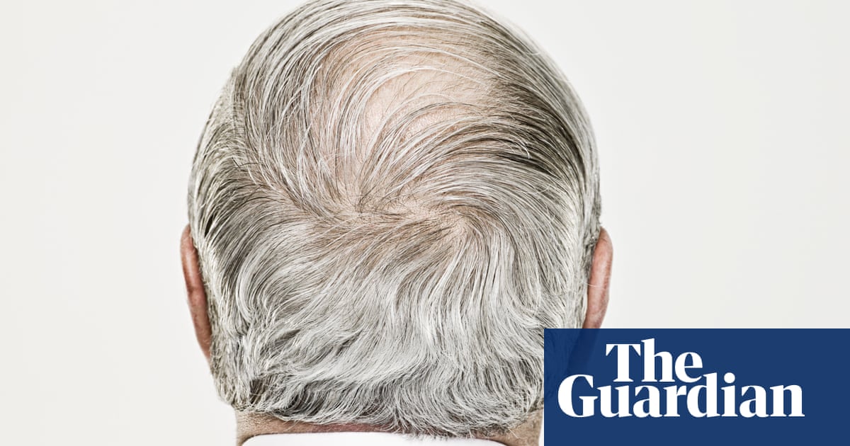Featured image for New Stem Cell Discovery Offers Hope for Gray Hair Reversal