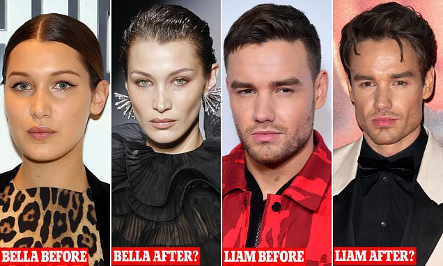 Surgeons caution against excessive cheek fat removal for chiselled appearance.