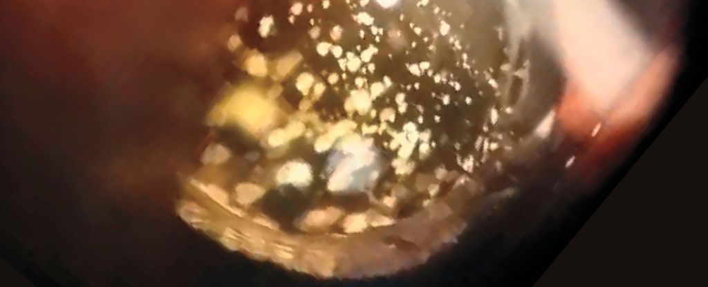 Featured image for "Rare Condition Causes Eyes to Sparkle Like Galaxies"